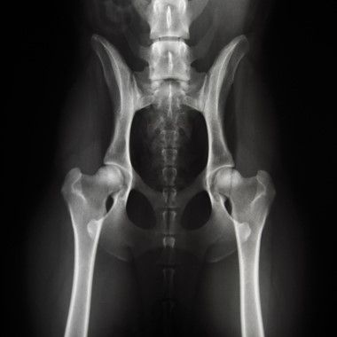 hüftgelenkdysplasie